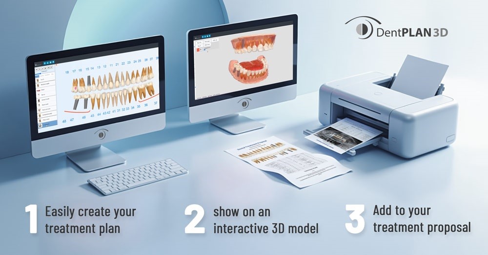DentPlant Trial (Copy)